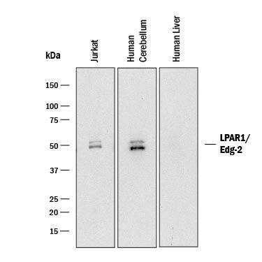 Detection of Human LPAR1/LPA1/EDG-2 antibody by Western Blot.