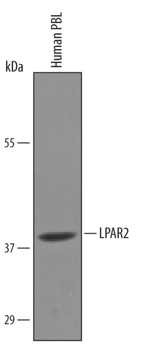 Detection of Human LPAR2 antibody by Western Blot.