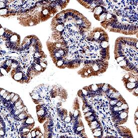 LPAR5/LPA5/GPR92 antibody in Human Colon by Immunohistochemistry (IHC-P).