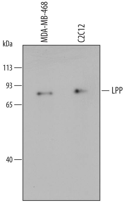 Detection of Human and Mouse LPP antibody by Western Blot.