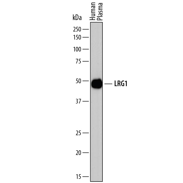 Detection of Human LRG1 antibody by Western Blot.