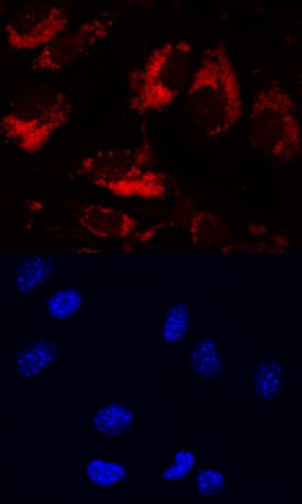 LRIG1 antibody in bEnd by Immunocytochemistry (ICC).3 Mouse Cell Line by Immunocytochemistry (ICC).