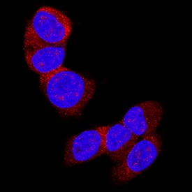 LRIG2 antibody in WM-115 Human Cell Line by Immunocytochemistry (ICC).