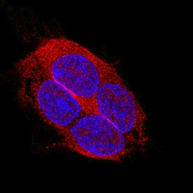LRIG2 antibody in WM-115 Human Cell Line by Immunocytochemistry (ICC).