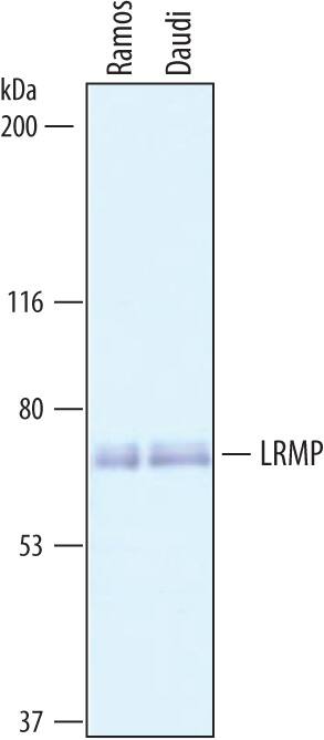 Detection of Human LRMP antibody by Western Blot.