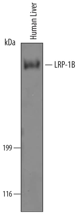 Detection of Human LRP-1B antibody by Western Blot.