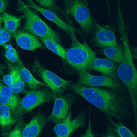 LRP-1 Cluster III antibody in MG-63 Human Cell Line by Immunocytochemistry (ICC).