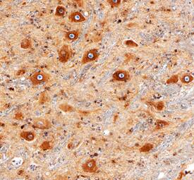 LRP-4 antibody in Human Brainstem by Immunohistochemistry (IHC-P).