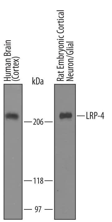 Detection of Human and Rat LRP-4 antibody by Western Blot.