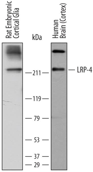 Detection of Human and Rat LRP-4 antibody by Western Blot.