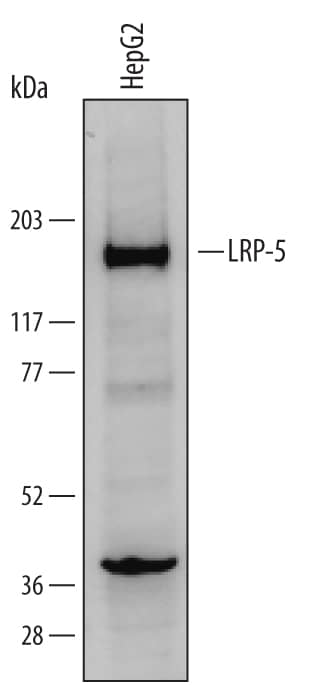 Detection of Human LRP-5 antibody by Western Blot.