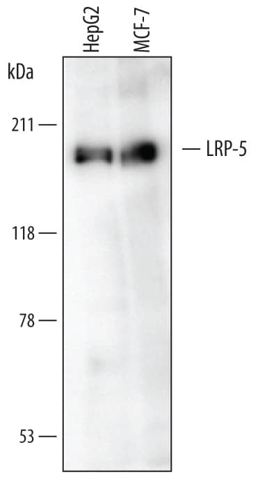 Detection of Human LRP-5 antibody by Western Blot.