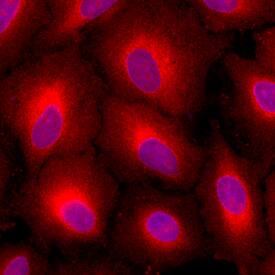 LRPAP antibody in A549 Human Cell Line by Immunocytochemistry (ICC).