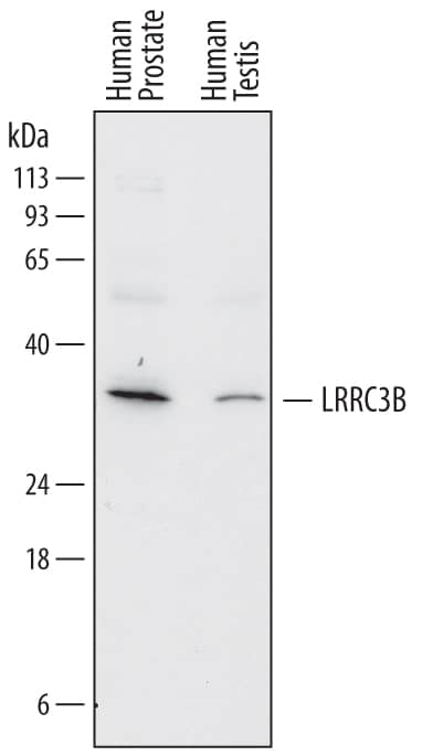 Detection of Human LRRC3B antibody by Western Blot.