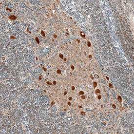 LRRC3 antibody in Human Brain by Immunohistochemistry (IHC-P).