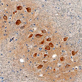 LRRC3 antibody in Human Brain by Immunohistochemistry (IHC-P).