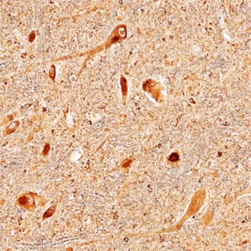 LRRC4 antibody in Human Brain by Immunohistochemistry (IHC-P).