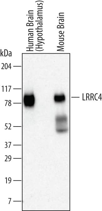 Detection of Human and Mouse LRRC4 antibody by Western Blot.