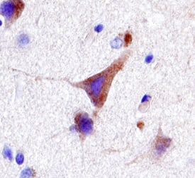 LRRK2 antibody in Human Brain by Immunohistochemistry (IHC-P).