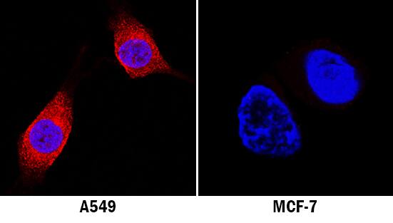 LRRK2 antibody in A549 Human Cell Line by Immunocytochemistry (ICC).