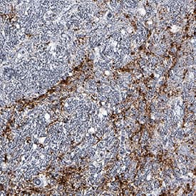 LRRK2 antibody in Human Brain by Immunohistochemistry (IHC-P).