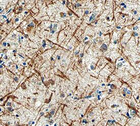 LRRTM3 antibody in Human Brain by Immunohistochemistry (IHC-P).