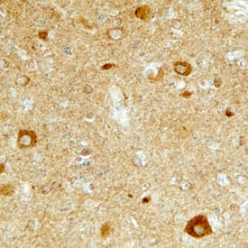 LTK antibody in Human Brain by Immunohistochemistry (IHC-P).