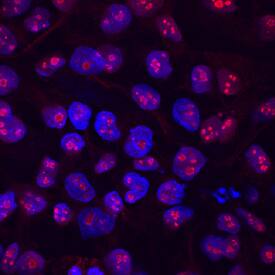 LYAR antibody in BG01V Human Stem Cells by Immunocytochemistry (ICC).