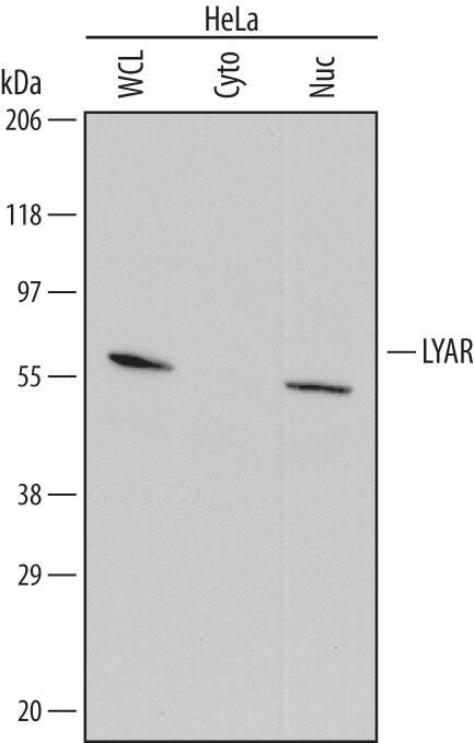 Detection of Human LYAR antibody by Western Blot.