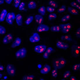 LYAR antibody in BG01V Human Embryonic Stem Cells by Immunocytochemistry (ICC).
