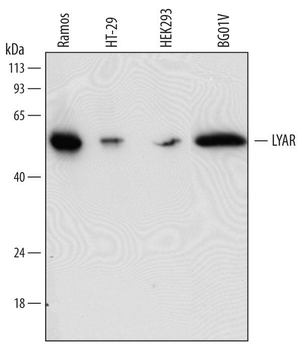 Detection of Human LYAR antibody by Western Blot.