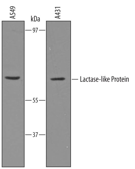 Detection of Human Lactase-like Protein/LCTL antibody by Western Blot.