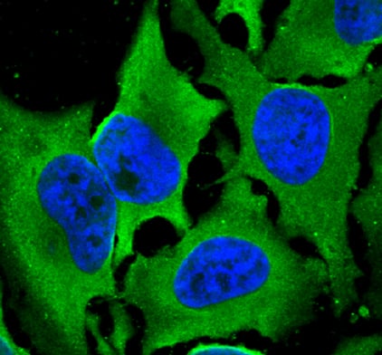 Laminin S antibody in HeLa Human Cell Line by Immunocytochemistry (ICC).