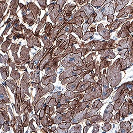 Laminin alpha 2 antibody in Human Heart by Immunohistochemistry (IHC-P).