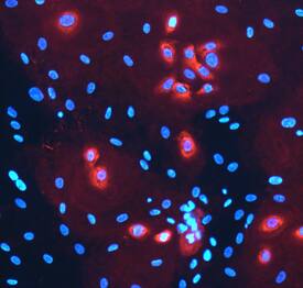 Laminin a3/Laminin-5 antibody in NHEK Human Cell Line by Immunocytochemistry (ICC).