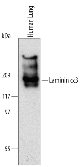 Detection of Human Laminin a3/Laminin-5 antibody by Western Blot.