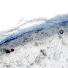 Laminin a3/Laminin-5 antibody in Human Skin by Immunohistochemistry (IHC-P).