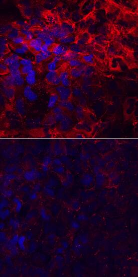 Laminin a4 antibody in T98G Human Cell Line by Immunocytochemistry (ICC).