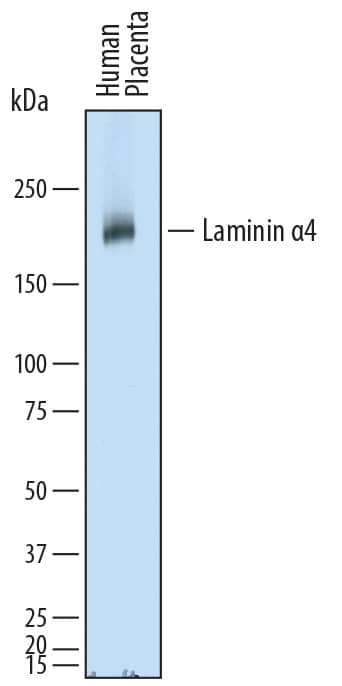 Detection of Human Laminin a4 antibody by Western Blot.