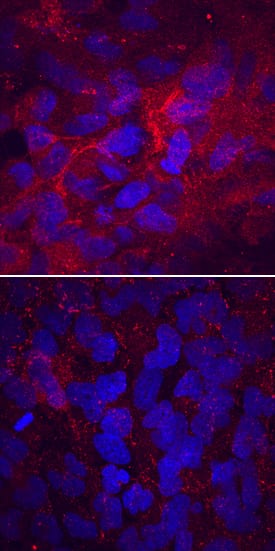 Laminin a4 antibody in T98G Human Cell Line by Immunocytochemistry (ICC).