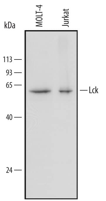 Detection of Human Lck antibody by Western Blot.