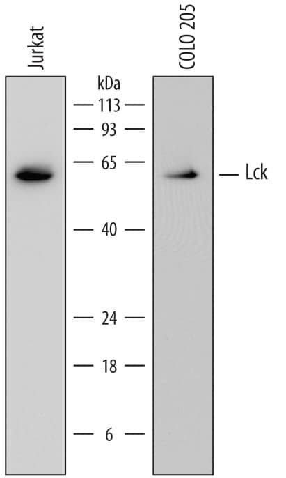 Detection of Human Lck antibody by Western Blot.