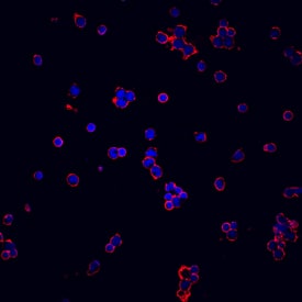 Lck antibody in Human PBMCs by Immunocytochemistry (ICC).