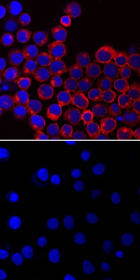 Phospho-Lck (Y394) antibody in Jurkat Human Cell Line by Immunocytochemistry (ICC).