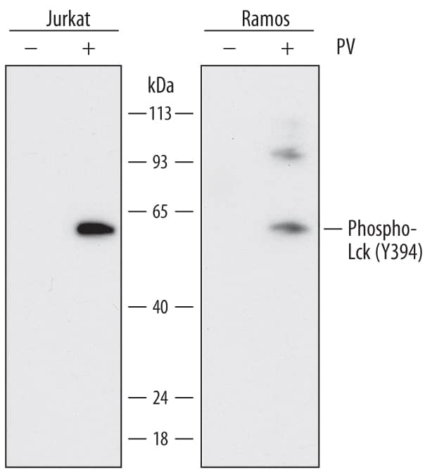 Detection of Human Phospho-Lck (Y394) antibody by Western Blot.