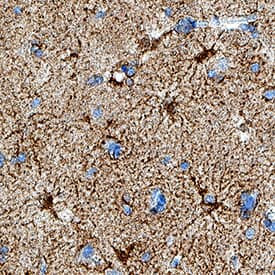 Leptin R antibody in Human Brain (Cortex) by Immunohistochemistry (IHC-P).