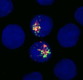 Lgr5/GPR49 antibody in NSO Mouse Cell Line Transfected with Human Lgr5/GPR49 by Immunocytochemistry (ICC).