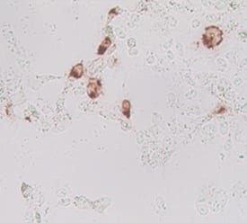 Lgr5/GPR49 antibody in Mouse Cells Transfected with Mouse Lgr5/GPR49 by Immunocytochemistry (ICC).