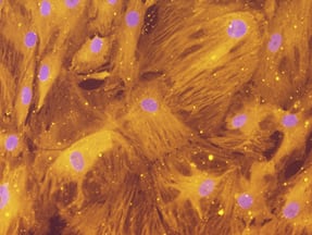 Lipin 1 antibody in Human Adipocytes by Immunocytochemistry (ICC).