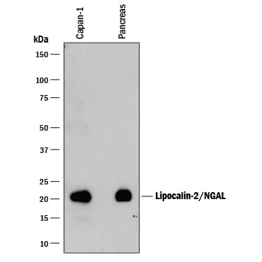 Detection of Human Lipocalin-2/NGAL antibody by Western Blot.